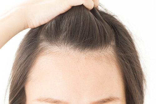 おでこ脱毛とは?効果や痛み、料金について